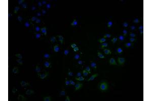 Immunofluorescence staining of A549 cells with ABIN7139992 at 1:100, counter-stained with DAPI.
