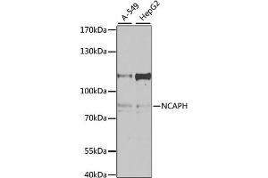 Western blot analysis of extracts of various cell lines, using NCAPH antibody. (NCAPH Antikörper)