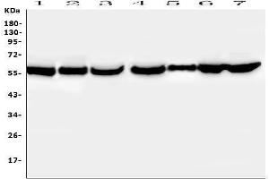 Western blot analysis of PTBP2 using anti-PTBP2 antibody (ABIN7599452).