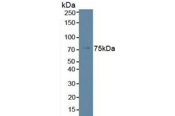 Phospholipase C beta 2 Antikörper  (AA 1-250)