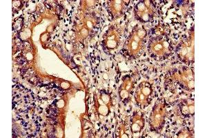 Immunohistochemistry of paraffin-embedded human small intestine tissue using ABIN7143509 at dilution of 1:100 (ARL4D Antikörper  (AA 2-201))