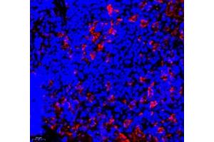 Immunofluorescence of paraffin embedded rat spleen using ANXA3 (ABIN7073065) at dilution of 1: 300 (400x lens) (Annexin A3 Antikörper)