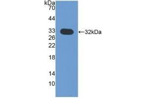Detection of Recombinant CHIT1, Mouse using Polyclonal Antibody to Chitinase 1 (CHIT1) (Chitotriosidase 1 Antikörper  (AA 210-464))