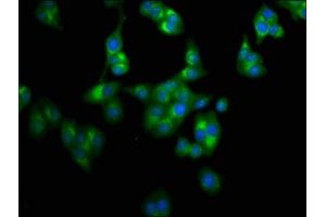 Immunofluorescence staining of HepG2 cells with ABIN7158788 at 1:100, counter-stained with DAPI. (LAPTM4A Antikörper  (AA 181-233))