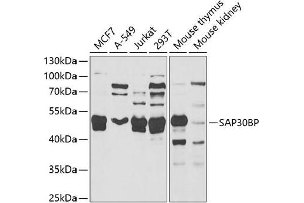 SAP30BP Antikörper  (AA 1-308)