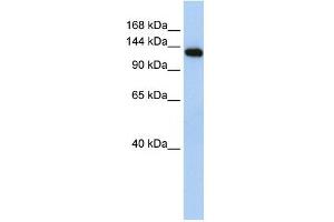 MYBPC2 antibody used at 1 ug/ml to detect target protein. (MYBPC2 Antikörper  (N-Term))