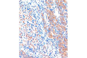 Immunohistochemistry of paraffin-embedded Rat ovary using ME3 Rabbit pAb (ABIN7268384) at dilution of 1:100 (40x lens). (ME3 Antikörper  (AA 505-604))