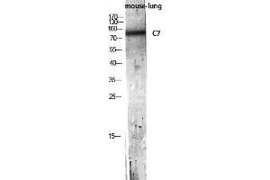 Western Blot (WB) analysis of Mouse Lung lysis using C7 antibody. (C7 Antikörper)