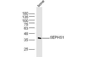 Mouse bone lysates probed with SEPHS1 Polyclonal Antibody, Unconjugated  at 1:300 dilution and 4˚C overnight incubation. (SEPHS1 Antikörper  (AA 2-100))