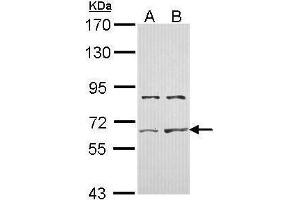 WB Image Sample (30 ug of whole cell lysate) A: Hela B: Hep G2 , 7. (ACVR2A Antikörper)