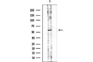 anti-Protein Phosphatase 3, Catalytic Subunit, beta Isozyme (PPP3CB) (C-Term) antibody