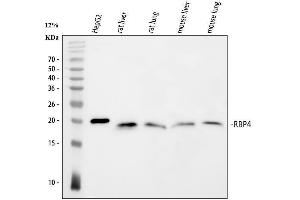 Western blot analysis of RBP4 using anti-RBP4 antibody (ABIN5519056).