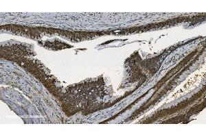 IHC analysis of U2AF65/U2AF2 using anti U2AF65/U2AF2 antibody (ABIN7600794). (U2AF2 Antikörper  (AA 238-470))