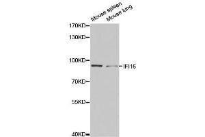 Western blot analysis of extracts of various cell lines, using IFI16 antibody. (IFI16 Antikörper  (AA 1-300))
