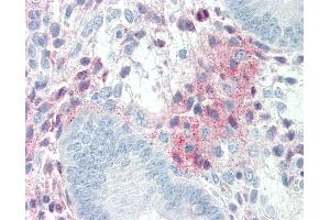 Immunohistochemistry (IHC) image for anti-serpin Peptidase Inhibitor, Clade F (Alpha-2 Antiplasmin, Pigment Epithelium Derived Factor), Member 1 (SERPINF1) (AA 196-347) antibody (ABIN337197)