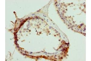 Immunohistochemistry of paraffin-embedded human testis tissue using ABIN7173467 at dilution of 1:100 (TRIM55 Antikörper  (AA 101-300))