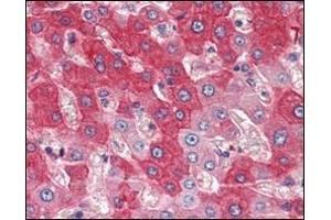 Immunohistochemical analysis of paraffin-embedded human liver tissues using FGFR4 antibody. (FGFR4 Antikörper)