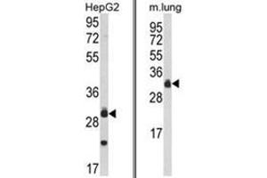 (LEFT) Western blot analysis of MyD88 Antibody (Center) in HepG2 cell line lysates (35ug/lane). (MYD88 Antikörper  (Middle Region))