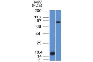 Western blot testing of 1) partial human recombinant protein and 2) human HeLa lysate with Factor XIIIa antibody (clone F13A1/1448). (F13A1 Antikörper  (AA 46-181))