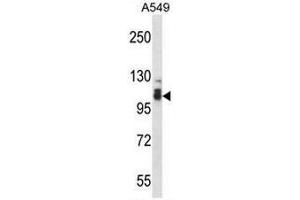 SMEK2 Antibody (C-term) western blot analysis in A549 cell line lysates (35µg/lane). (SMEK2 Antikörper  (C-Term))