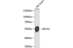 Western blot analysis of extracts of Rat brain using EIF2S3 Polyclonal Antibody at dilution of 1:1000. (EIF2S3 Antikörper)