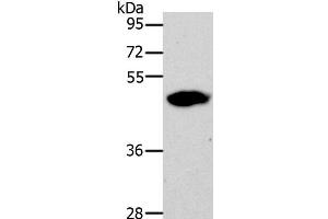 Western Blot analysis of 293T cell using LOX Polyclonal Antibody at dilution of 1:500 (LOX Antikörper)