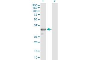 Western Blot analysis of TRADD expression in transfected 293T cell line by TRADD MaxPab polyclonal antibody. (TRADD Antikörper  (AA 1-312))