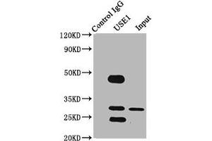 Immunoprecipitating USE1 in PC-3 whole cell lysate Lane 1: Rabbit control IgG (1 μg) instead of ABIN7175459 in PC-3 whole cell lysate. (UBE2Z Antikörper  (AA 1-146))
