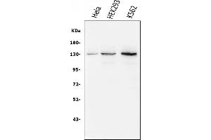 Western blot analysis of BubR1/BUB1B using anti-BubR1/BUB1B antibody (ABIN7600960). (BUB1B Antikörper  (AA 26-448))
