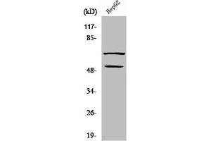 Western Blot analysis of COLO205 cells using SYT Polyclonal Antibody (SS18 Antikörper  (N-Term))