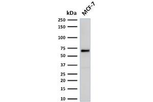 Western Blot Analysis of human MCF-7 cell lysate using Estrogen Receptor, alpha Mouse Recombinant Monoclonal Antibody (rESR1/1935). (Rekombinanter Estrogen Receptor alpha Antikörper)