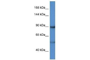 Western Blot showing LPIN2 antibody used at a concentration of 1 ug/ml against Hela Cell Lysate