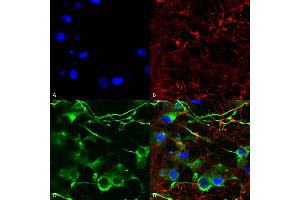 Immunocytochemistry (ICC) image for anti-Solute Carrier Family 12 (Potassium-Chloride Transporter) Member 5 (SLC12A5) (AA 932-1043) antibody (HRP) (ABIN2484119)