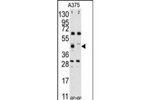 Western blot analysis of anti-FDFT1 Antibody (Center) (ABIN389052 and ABIN2839261) pre-incubated without(lane 1) and with(lane 2) blocking peptide (BP2417b) in  cell line lysate. (FDFT1 Antikörper  (AA 140-170))