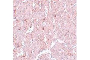 Immunohistochemical staining of rat liver tissue with NR1H3 polyclonal antibody  at 5 ug/mL dilution. (NR1H3 Antikörper  (N-Term))