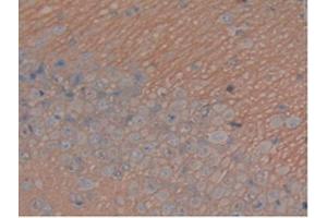 IHC-P analysis of Rat Brain Tissue, with DAB staining. (MAPT Antikörper  (AA 34-368))