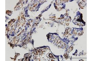 Immunoperoxidase of monoclonal antibody to DKK1 on formalin-fixed paraffin-embedded human placenta. (DKK1 Antikörper  (AA 1-266))