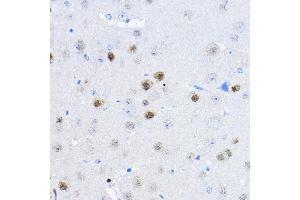 Immunohistochemistry of paraffin-embedded mouse brain using RPP25 Rabbit pAb (ABIN6133248, ABIN6147176, ABIN6147177 and ABIN6225317) at dilution of 1:100 (40x lens). (RPP25 Antikörper  (AA 1-199))