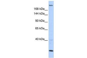 TNRC6B antibody used at 1 ug/ml to detect target protein. (TNRC6B Antikörper  (N-Term))