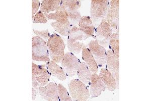 Immunohistochemical analysis of paraffin-embedded H. (SLC25A25 Antikörper  (N-Term))