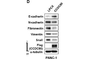 Ectopic expression of CCDC80 reducing migration, colony formation, and EMT in pancreatic cancer cells. (CCDC80 Antikörper  (AA 201-300))