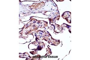 Immunohistochemistry (IHC) image for anti-Neural Precursor Cell Expressed, Developmentally Down-Regulated 9 (NEDD9) antibody (ABIN2998097) (NEDD9 Antikörper)