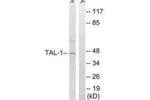 Western blot analysis of extracts from Jurkat cells, treated with PMA (125 ng/mL, 30 mins), using TAL-1 (Ab-122) antibody. (TAL1 Antikörper  (Ser122))