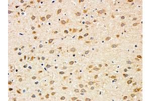 Immunohistochemistry (IHC) image for anti-Brain-Derived Neurotrophic Factor (BDNF) (Internal Region) antibody (ABIN5539690)