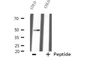 Western blot analysis of extracts from HepG2 cells, using AZI2 antibody. (AZI2 Antikörper  (N-Term))