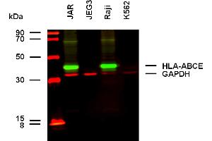 Anti-HLA-ABCE Purified (clone TP25. (HLA-A+B+C+E Antikörper)