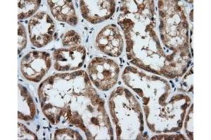 Immunohistochemical staining of paraffin-embedded Kidney tissue using anti-PSMC3 mouse monoclonal antibody. (PSMC3 Antikörper)
