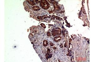 Immunohistochemistry (IHC) image for anti-Radical S-Adenosyl Methionine Domain Containing 2 (RSAD2) (Internal Region) antibody (ABIN6287610)