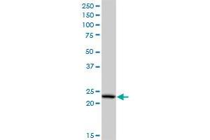 PCTP monoclonal antibody (M03A), clone 3A11. (PCTP Antikörper  (AA 106-214))