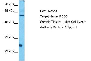 Host: Rabbit Target Name: PEBB Sample Type: Jurkat Whole Cell lysates Antibody Dilution: 0. (CBFB Antikörper  (N-Term))